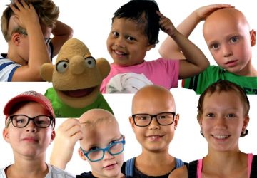 Wat is Alopecia nu eigenlijk?